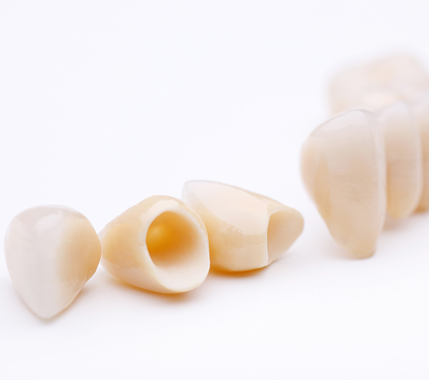 Feeding Hills Dental Crowns and Dental Bridges