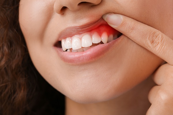 Does Gum Disease Put The Entire Body At Risk?