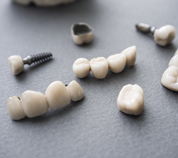 Feeding Hills The Difference Between Dental Implants and Mini Dental Implants