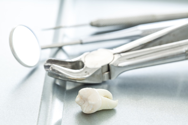 Recovering From A Tooth Extraction: What To Expect