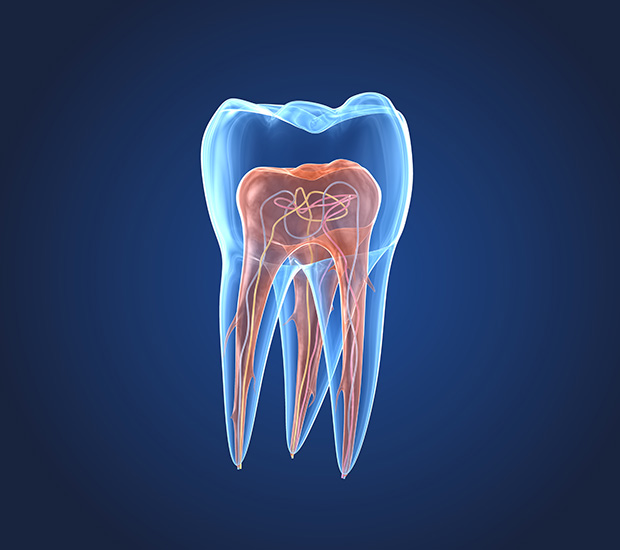 Feeding Hills What is an Endodontist